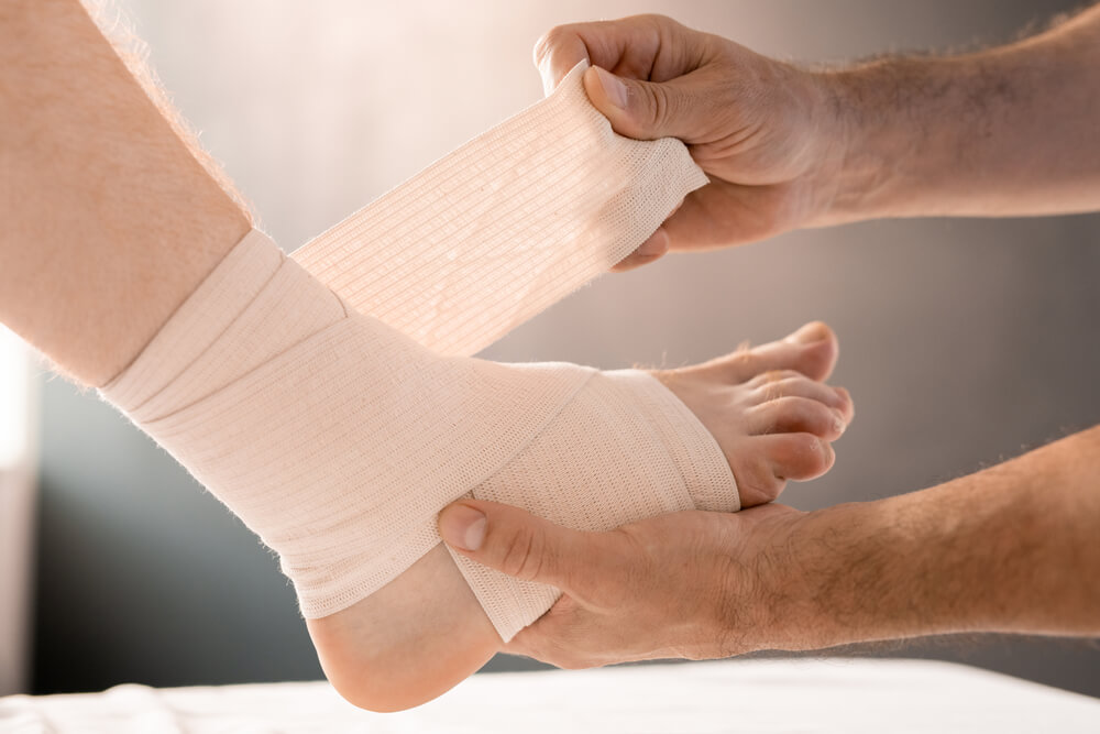 Ankle Sprain